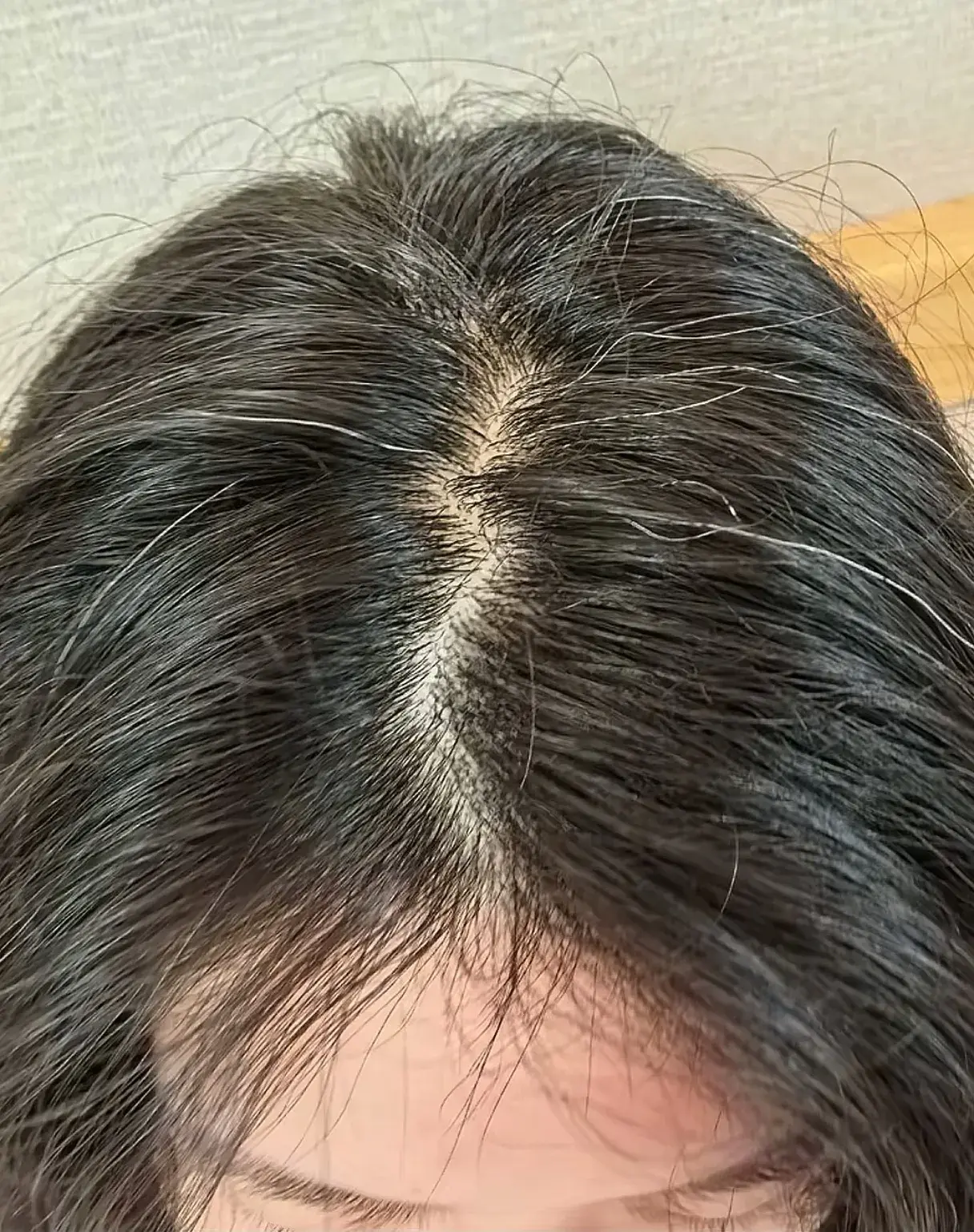 十根白头发, 扣球